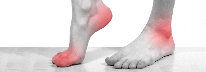 Chiropractic The Colony TX Understanding Peripheral Neuropathy Black and white picture of feet with red pain in toes and heel